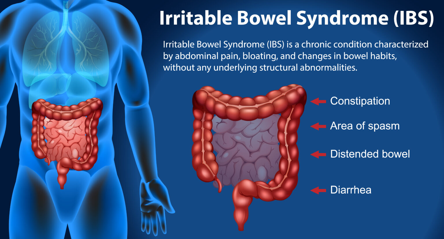 IBS & Gut Health